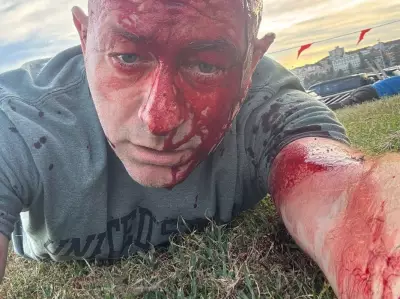 Bondi Beach Massacre: A Canadian Call to Action Against Rising Antisemitism