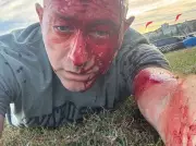 Antisemitic Conspiracy Theories Surge Globally After Oct. 7 Attacks