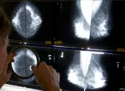 Study: Black Women Face 70% Higher Breast Cancer Mortality Rate