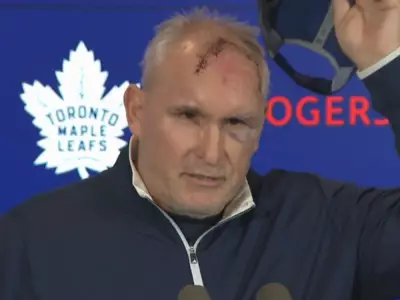 Maple Leafs Coach Craig Berube Shows Off Gym Injury Battle Scars