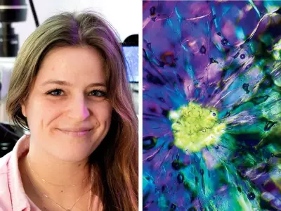 Montreal Microbiologist's Microscopic Art Attracts 1M Instagram Followers