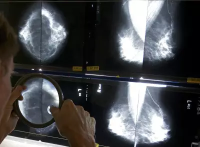 Saskatchewan Lowers Breast Cancer Screening Age to 43 in 2026