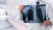 Pneumonia Deaths Surge 20% in Canada During 2024, StatCan Reports