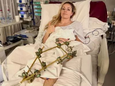 Lindsey Vonn Undergoes Third Surgery After 2026 Olympic Downhill Crash