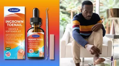 Totclear Ingrown Toenail Kit Offers Home Relief for Under $20