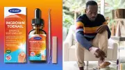 Totclear Ingrown Toenail Kit Offers Home Relief for Under $20