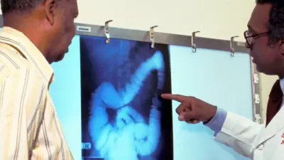 Advocates Urge Canada to Lower Colorectal Cancer Screening Age