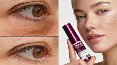 Dr. Melaxin Calcium Balm on Sale: Topical Skincare Breakthrough