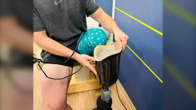 SFU Researchers Develop Revolutionary 3D-Printed Prosthetic Sockets in B.C.