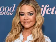 Denise Richards Unveils Dramatic Facelift Transformation in Shocking Before-and-After Photos