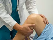 Post-Knee Replacement Recovery: How Fitness Level Impacts Return to Physical Activity