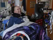 Psilocybin Microdoses Show Promise in Easing Palliative Patient Distress