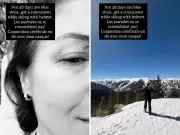 Sophie Grégoire Trudeau Suffers Concussion in Skiing Accident, Shares Recovery Update