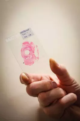 Alberta Expands Cancer Care with Earlier Breast Screening and Enhanced Fertility Program