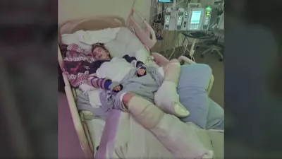 B.C. Ministry Implements New Safeguards After Teen with Special Needs Suffers Burns