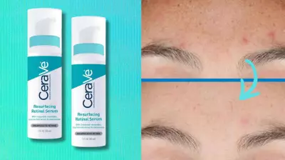 CeraVe's Resurfacing Retinol Serum: A BOGO 50% Off Deal on Amazon