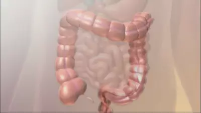 Colorectal Cancer Prevention: Essential Screening Guidelines and Steps