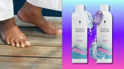 Lee Beauty Callus Remover Gel: 20% Off for Summer-Ready Feet