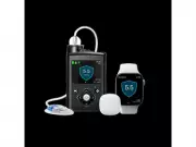 MiniMed Simplera Sync Sensor Gets Health Canada License for Type 2 Diabetes