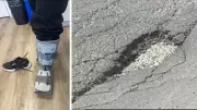 Montreal woman fractures ankle in pothole after concert