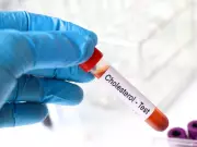 Updated Heart Guidelines Lower LDL Thresholds, Urge Earlier Screening