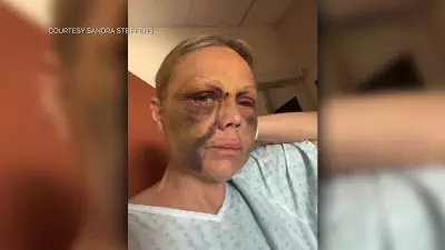CTrain Attack Victim Speaks Out: ‘I Got Beaten’ in Calgary