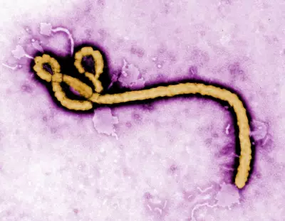 Dutch Hospital Admits Patient with Low Suspicion of Ebola
