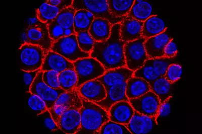 Experimental Pill Shows Promise for Deadly Pancreatic Cancer