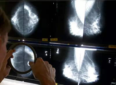 High Breast Cancer Rates in Canadian Regions: Study