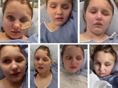 Maya Gebala's 5th Surgery a Success After Tumbler Ridge Shooting
