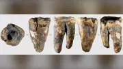 59,000-Year-Old Neanderthal Tooth Reveals Ancient Dental Care
