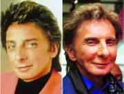 Barry Manilow, 82, admits to one facelift, denies Botox rumors