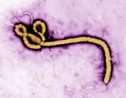 Brazil Investigates Two Possible Ebola Cases Amid Global Health Concerns