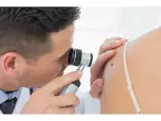 Free Skin Cancer Screenings on Parliament Hill by CDA and Melanoma Canada