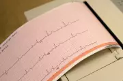 Heart Failure Rising Among Younger Canadians, Cardiologist Explains