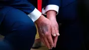 Trump's Physical Exam Unlikely to Reveal Mental Health Insights