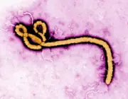 U.S. Airport Screening for Ebola Begins After First American Infection