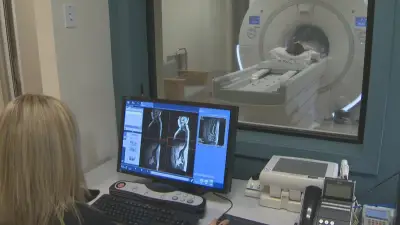 Alberta Scrapped Medical Scan Reimbursement Policy in 2025