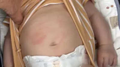 Calgary police seek youth who hit sleeping baby in torso