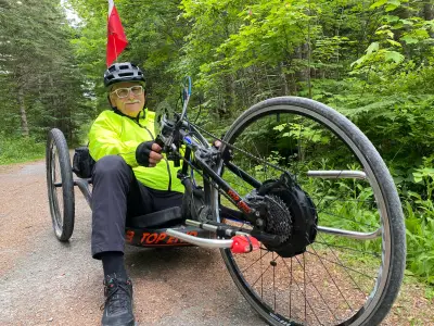 Cancer Survivor and Amputee Trains for 50km Ride for Cancer