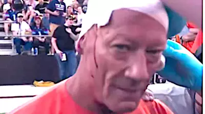 Fox Sports Cameraman Dave Bloodied but Blows Kiss After Sideline Collision