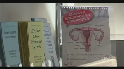 Pop-Up Cervical Screening Clinics Fill Care Gap for Patients Without Family Doctors