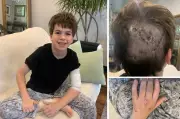 11-Year-Old Dog Attack Survivor Recalls Harrowing Ordeal