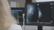 B.C. mammogram results delayed due to critical technician shortage