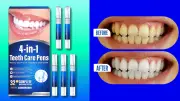 Budget Teeth Whitening Kit Under $17 Gets Rave Reviews