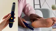 Dr. Scholl's Electric Callus Remover: A Game-Changer for Dry Feet
