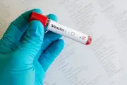 Measles exposure possible at Pearson Airport, on 2 flights: health unit