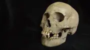 Oldest Plague Evidence Found in Siberia, 5,500 Years Old