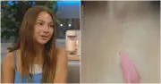 Teen Suffers Second-Degree Burns from Microwaving Squishy Toy Trend