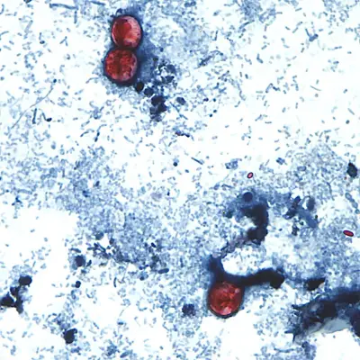 Cyclospora parasite infects over 1,200 in Michigan, not in Canada: PHAC